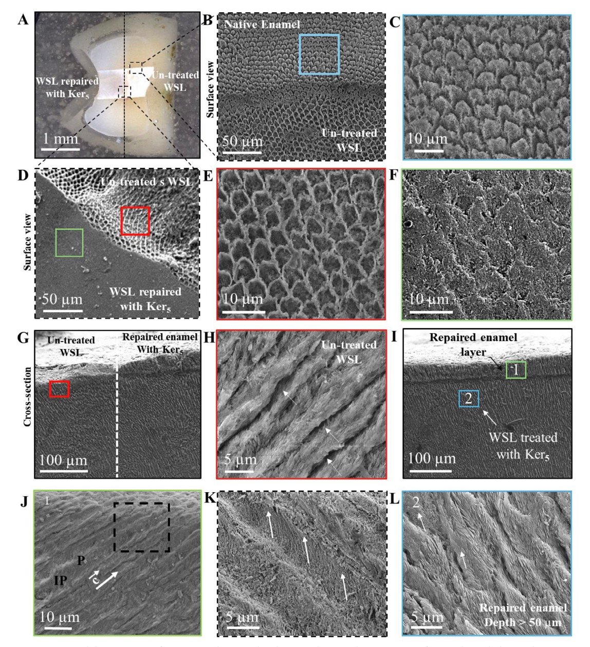 Clinical dental biomaterials and enamel repair strategies
